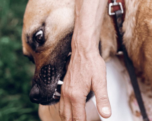 A brown dog bites a person’s hand while restrained on a leash, symbolizing a dog attack. The image supports a legal blog explaining what to do after being bitten by a dog at a friend’s house in Dallas and how Texas law and homeowners’ insurance handle liability for dog bite injuries on private property.