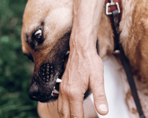 A brown dog bites a person’s hand while restrained on a leash, symbolizing a dog attack. The image supports a legal blog explaining what to do after being bitten by a dog at a friend’s house in Dallas and how Texas law and homeowners’ insurance handle liability for dog bite injuries on private property.